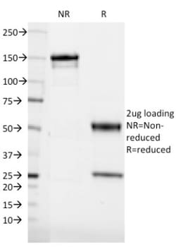 CD36 Antibody (185-1G2), Novus Biologicals:Antibodies:Primary Antibodies